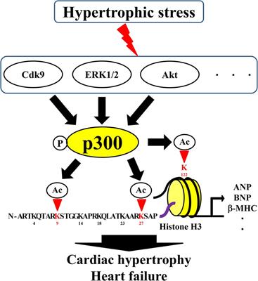 Roles of histone acetylation sites in cardiac hypertrophy and heart failure